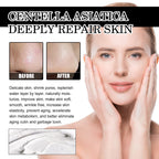 Blackhead Peeling Nose Mask