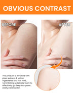 Turmeric Oil For The Face