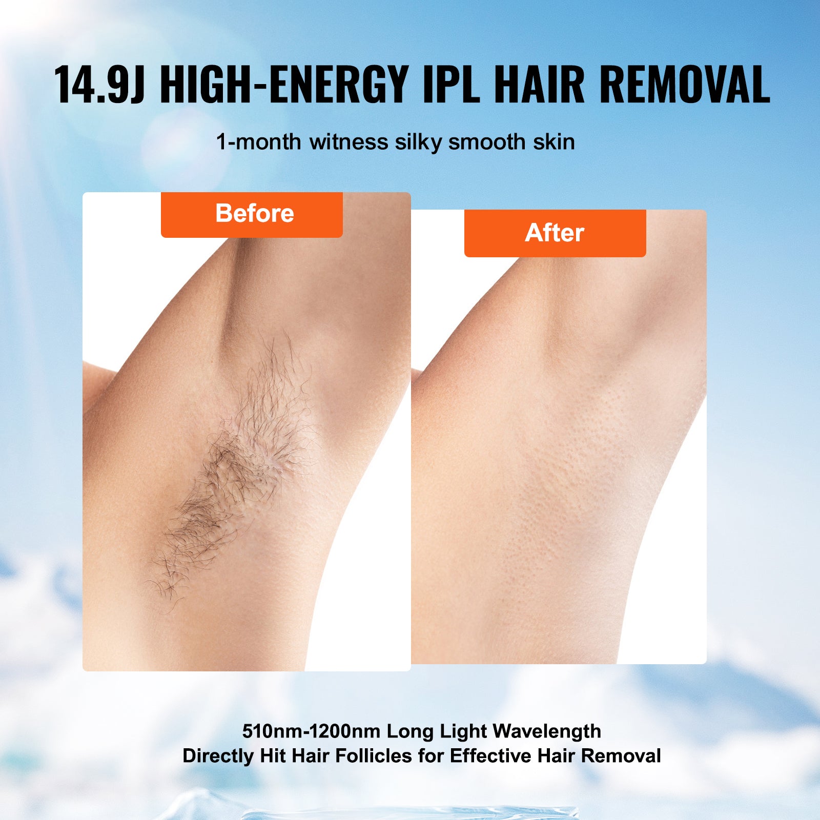 VEVOR IPL Hair Removal